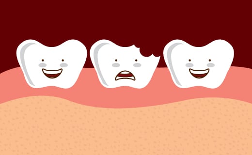 dca-blog_chipped-tooth-sad-illustration