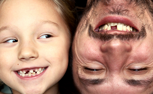dca-blog_dentures-vs-dental-implants2
