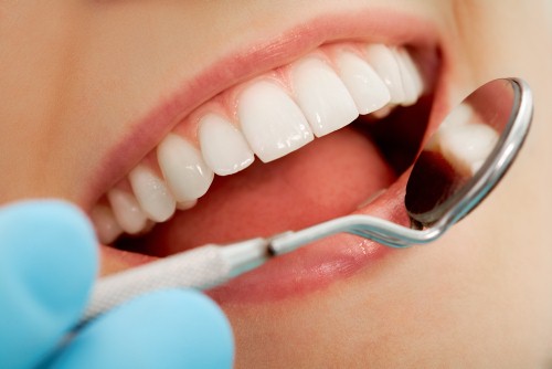 Do you know what a dental crown is?